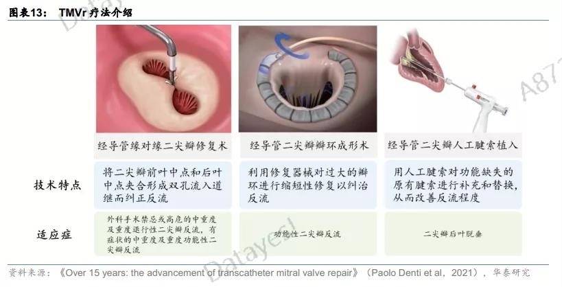 tmvr是將修復組件通過輸送系統直接作用在二尖瓣上,可以經導管緣對